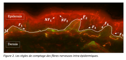 Innerve