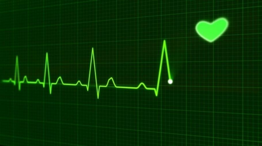 ECG2